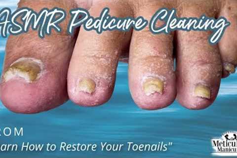 👣ASMR Pedicure Cleaning💆‍♀️Learn to Restore Your Toenails👣