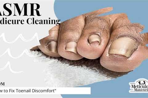 👣ASMR Pedicure Cleaning💆‍♀️ How to Fix Toenail Discomfort👣