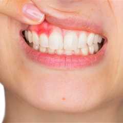 Gum Recession Grow Back? Proven Treatments - Teeth for Better Health